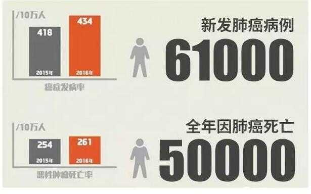 科學(xué)認(rèn)識肺部結(jié)節(jié)