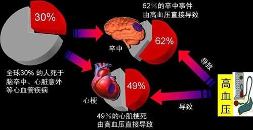 沒癥狀不代表沒傷害，高血壓對身體的危害你知道多少？
