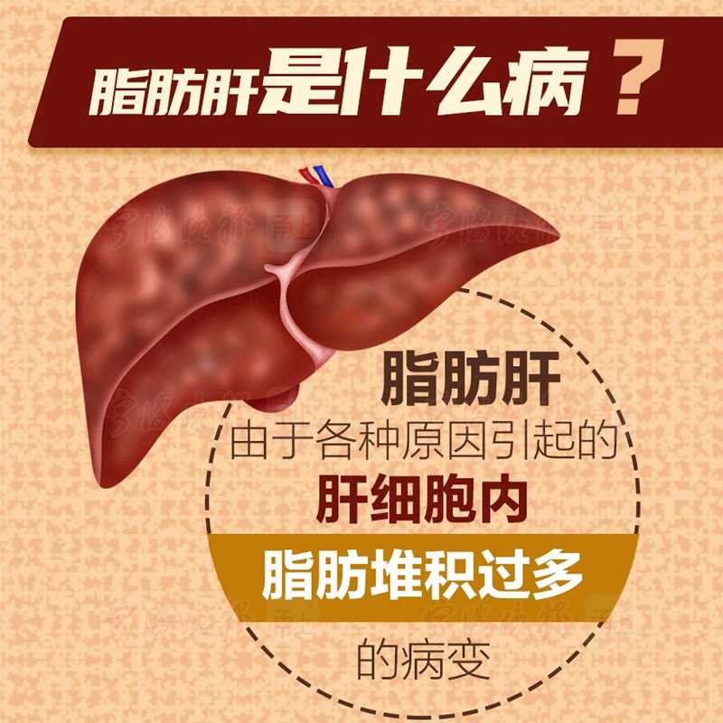 哪些藥物可以治療脂肪肝？