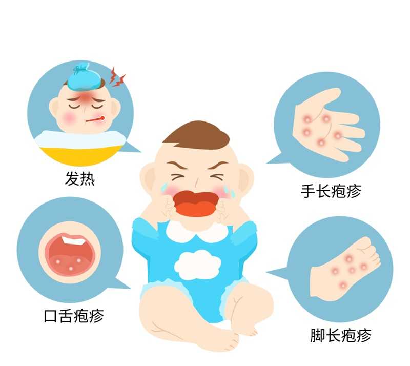 什么是手足口??？如何避免孩子感染手足口?。? width=