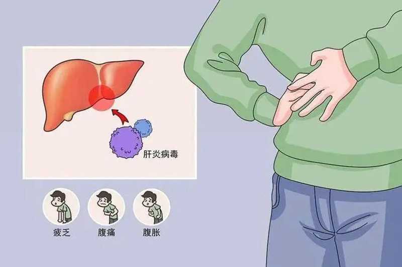 什么是肝硬化？肝硬化是如何慢慢發(fā)生的！