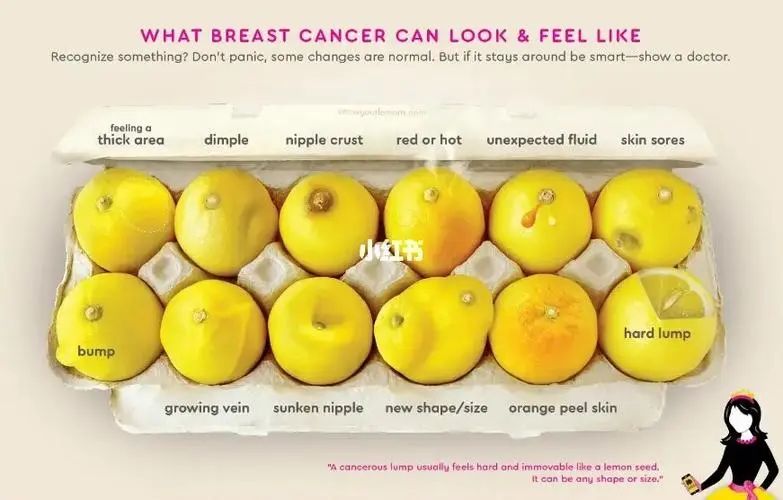 什么是乳腺癌？為什么會(huì)患乳腺癌？乳腺癌的早期癥狀有哪些？一文讀懂！