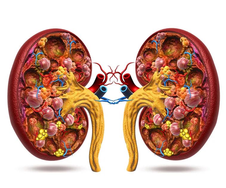 9個血糖指標(biāo)異常，你的腎臟可能已經(jīng)受傷了！