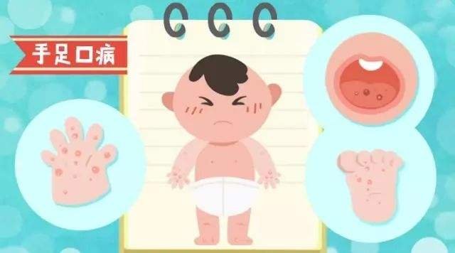 手足口病高發(fā)，傳染性強(qiáng)，可不是普通的感冒發(fā)熱！出現(xiàn)以下癥狀要警惕