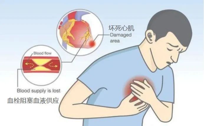 吹空調(diào)面癱？吹空調(diào)差點(diǎn)猝死？空調(diào)病是因?yàn)槟悴徽_使用空調(diào)！
