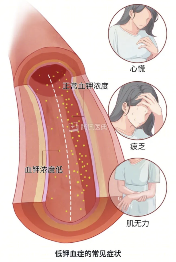 男人腎不行，更容易得高血壓！關(guān)注腎血管性高血壓癥