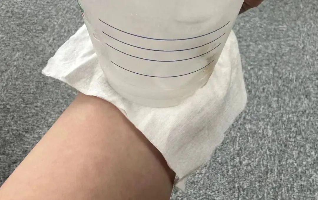 被蚊子咬了怎么辦？教你一個(gè)被蚊子咬了瞬間止癢的方法！
