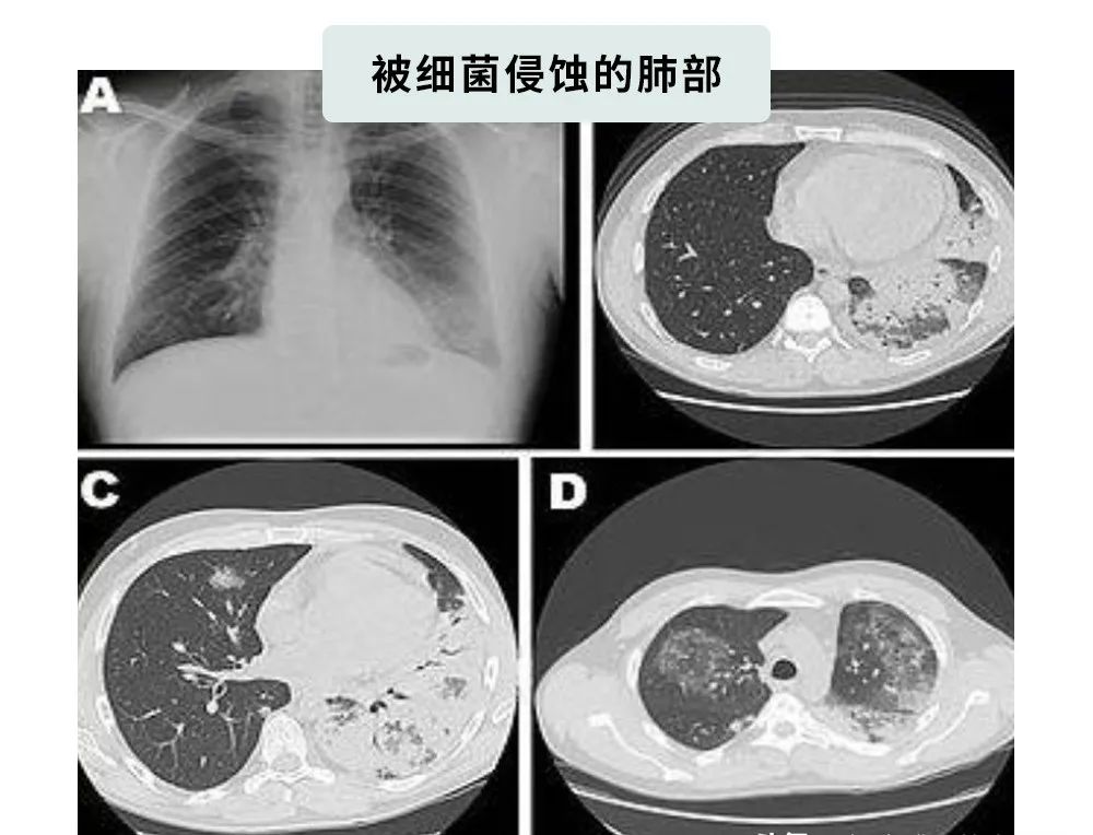 吹空調(diào)面癱？吹空調(diào)差點(diǎn)猝死？空調(diào)病是因?yàn)槟悴徽_使用空調(diào)！