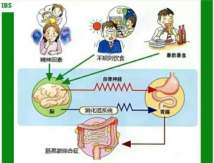 一緊張就會(huì)肚子痛，多半是腸易激綜合征