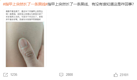 指甲長(zhǎng)黑線(xiàn)、杵狀指、手指結(jié)節(jié)腫塊，三種手指的特異變化，要警惕是癌癥信號(hào)！